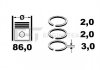 Набор поршневых колец ET ENGINETEAM R1002400 (фото 2)