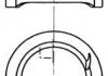 Поршень KOLBENSCHMIDT 94798600 (фото 1)